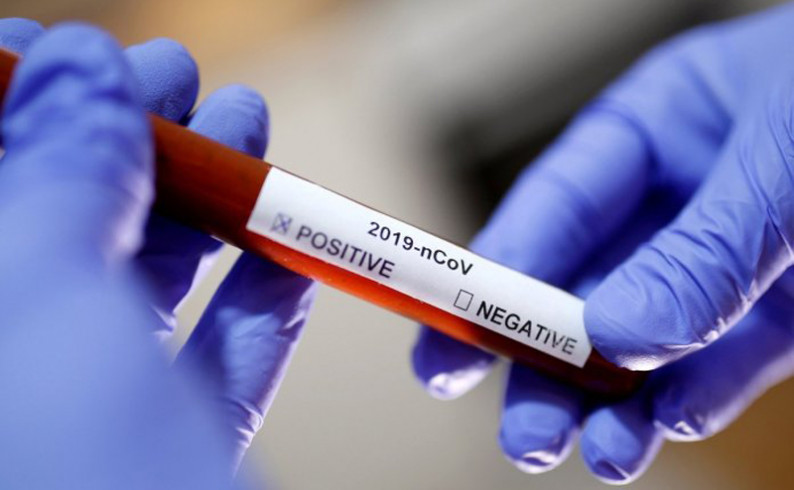 Foča: Epidemiološka situacija u pogoršanju
